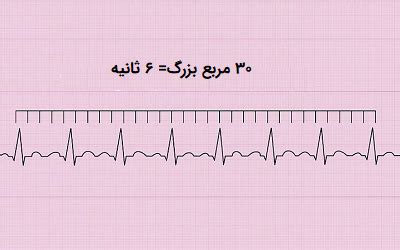 lv یعنی چی|تفسیر اکو قلب .